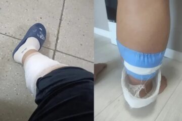 В Кокшетау беременную женщину покусала стая бродячих собак