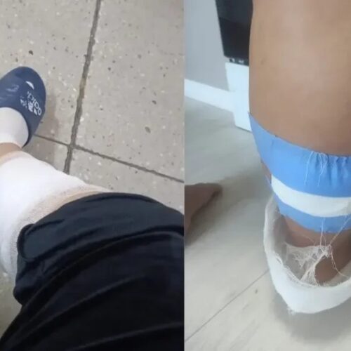 В Кокшетау беременную женщину покусала стая бродячих собак