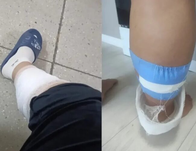 В Кокшетау беременную женщину покусала стая бродячих собак